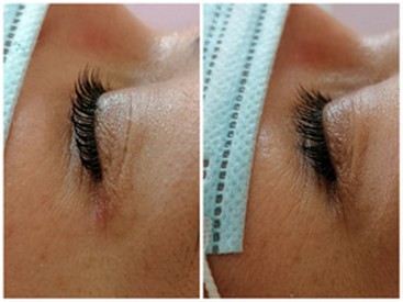 wimperlifting - lash lift